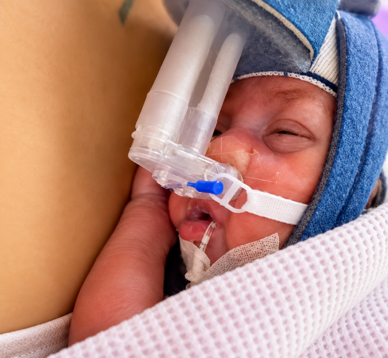 À seulement 351 grammes à la naissance, cette petite fille née à 21 semaines a survécu — média 3