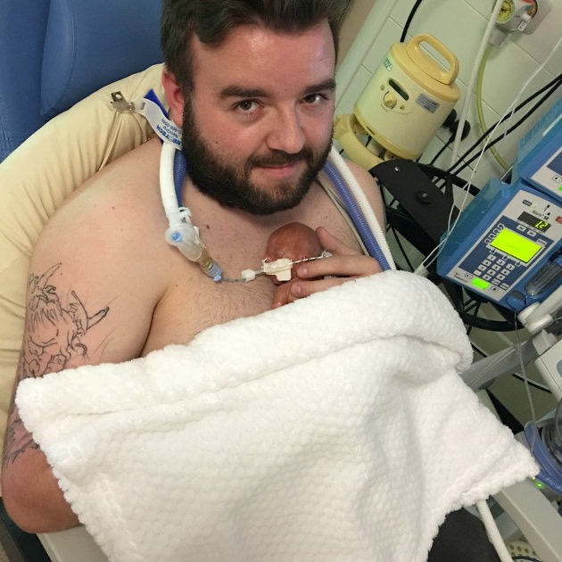 Né à seulement 22 semaines, Oliver s’accroche à la vie malgré des chances infimes de survie — média 2