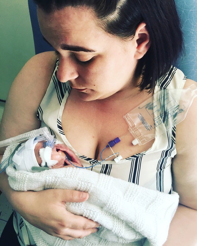 Né à seulement 22 semaines, Oliver s’accroche à la vie malgré des chances infimes de survie — média 3