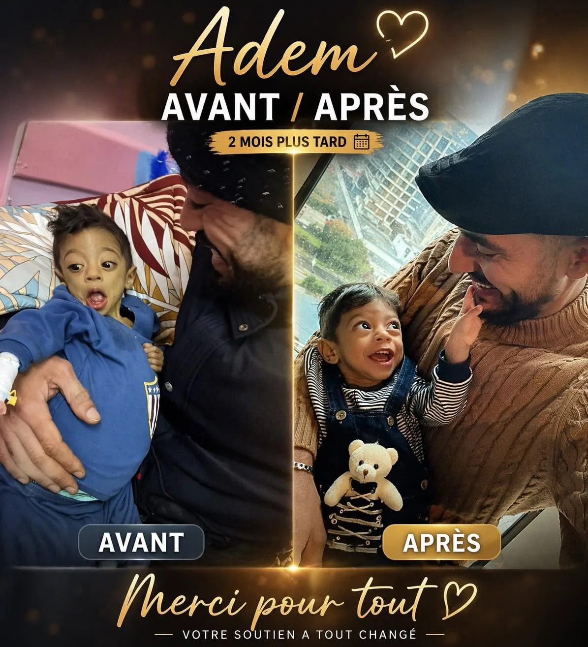 Photo d'Adem, un jeune garçon souriant, après sa greffe de foie réussie, avant son retour en Algérie.