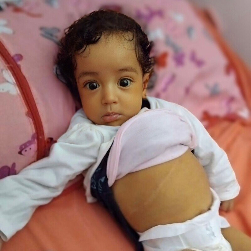 Photo de Emergency for little Watine (Algeria)