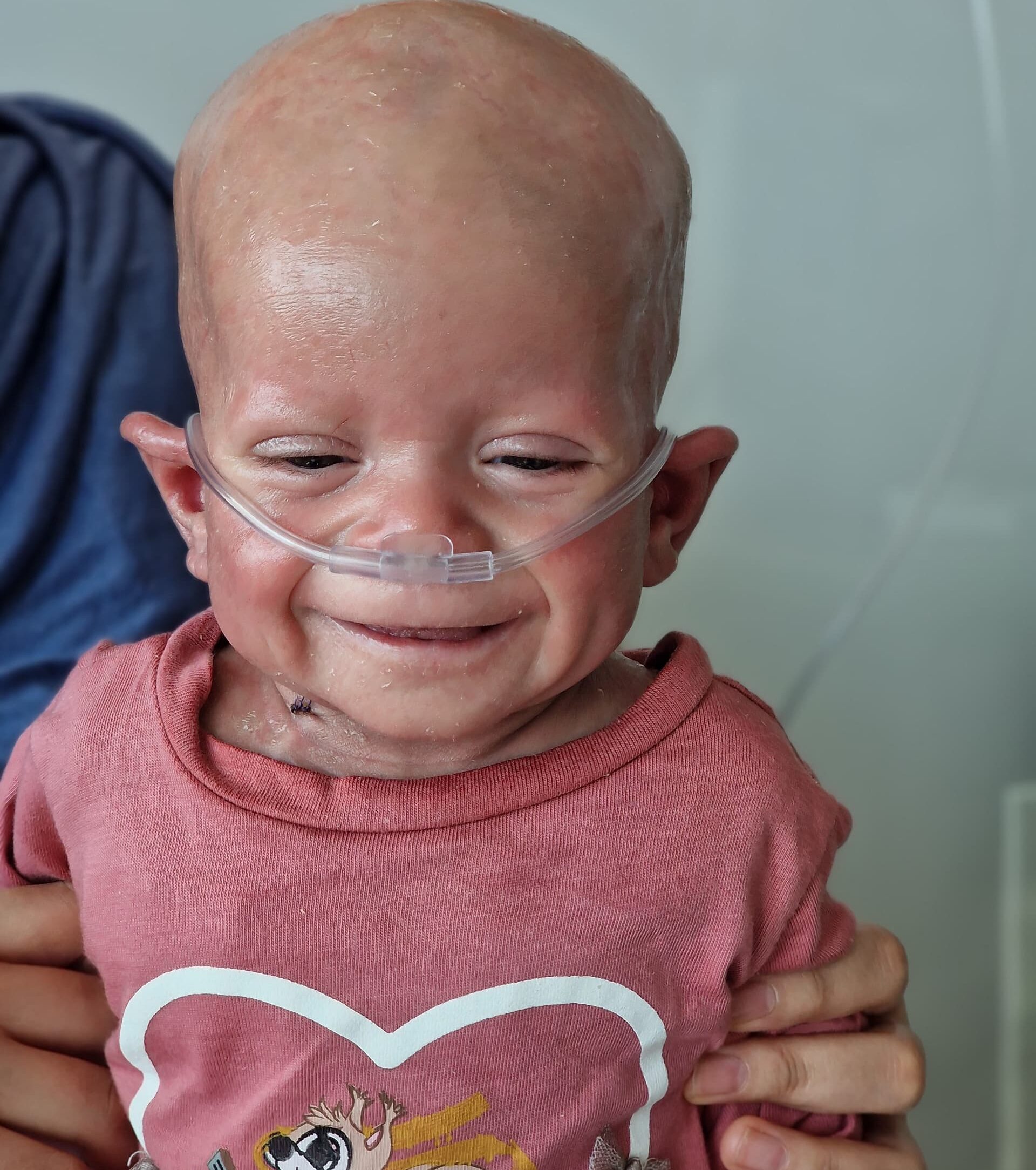 Enfant souriant après son opération — le résultat de votre générosité